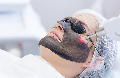 Hollywood Peel - Carbon Peel (Facial de rejuvenecimiento)