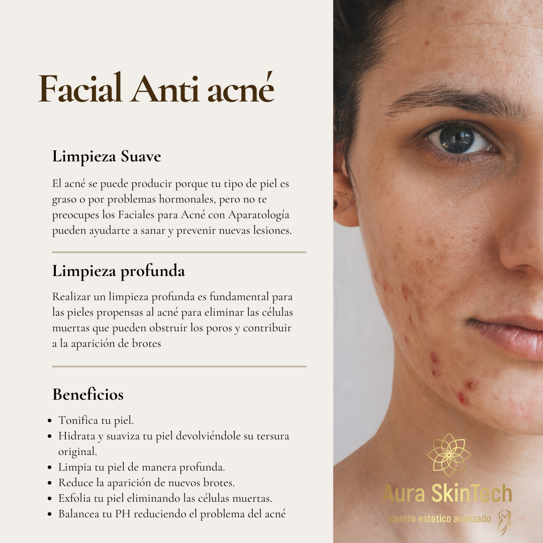 Facial para tratar el Acné (Adolescentes y Adultos)