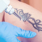 Eliminación de tatuajes - Agenda tu cita para valoración